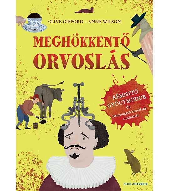 Meghökkentő orvoslás – Rémisztő gyógymódok és borzongató kezelések a múltból